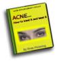 ACNE...How to treat it and beat it